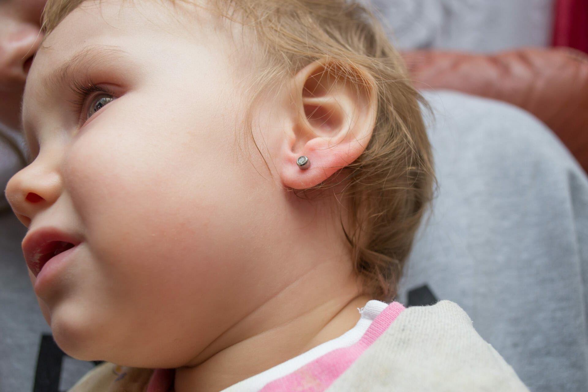 a little girl is treated with a wound on the earlobe after earring piercing