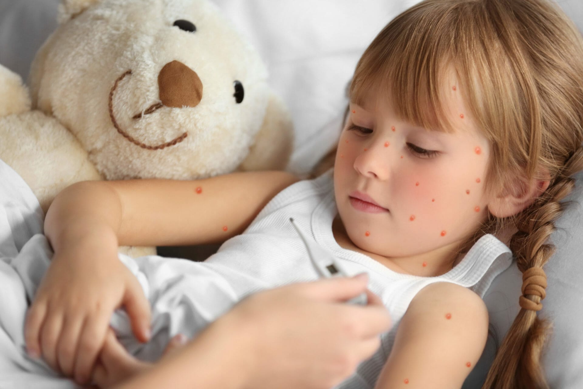 Mother measuring temperature of little girl with red pimples. Chicken pox concept